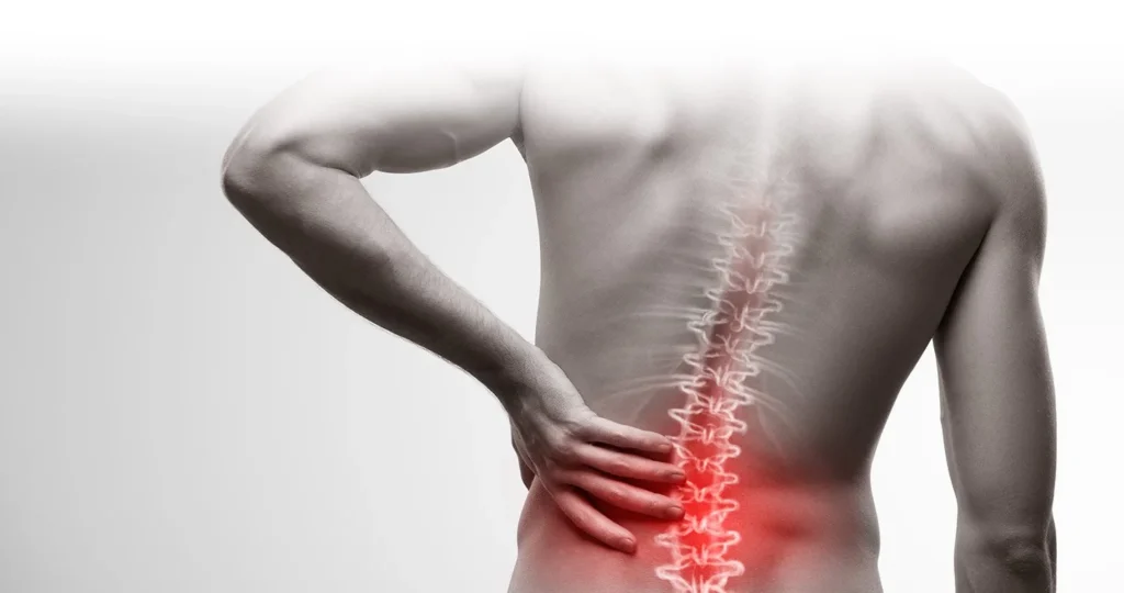 Back Pain 1024x540